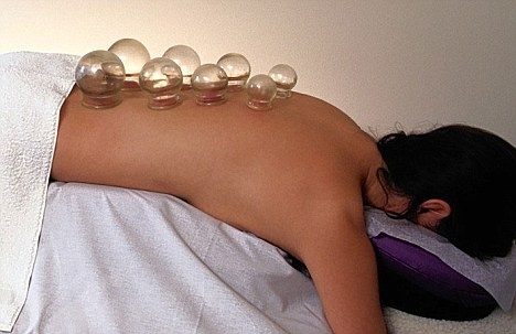 cupping
